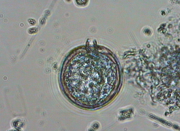 Dictyocha speculum